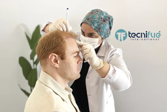 Hair Transplant